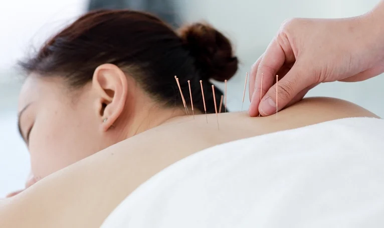 Acupoint Massage Ann Karen Day Spa