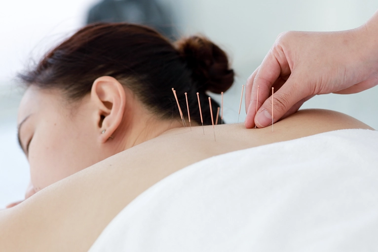 Acupoint Massage Ann Karen Day Spa